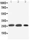 Surfactant Protein A1 antibody, GTX10761, GeneTex, Western Blot image 