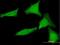 Small Glutamine Rich Tetratricopeptide Repeat Containing Alpha antibody, H00006449-B01P, Novus Biologicals, Immunofluorescence image 