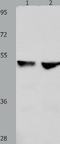 Cyclin Dependent Kinase 9 antibody, TA323196, Origene, Western Blot image 