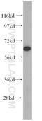 Dihydropyrimidinase Like 2 antibody, 14521-1-AP, Proteintech Group, Western Blot image 