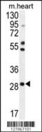 Ring Finger Protein 183 antibody, 55-143, ProSci, Western Blot image 