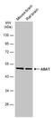 4-Aminobutyrate Aminotransferase antibody, PA5-78667, Invitrogen Antibodies, Western Blot image 
