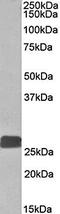 Dual Specificity Phosphatase 6 antibody, orb79350, Biorbyt, Western Blot image 