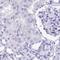 Gal-4 antibody, NBP2-48605, Novus Biologicals, Immunohistochemistry paraffin image 