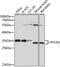 Pyrroline-5-Carboxylate Reductase 2 antibody, GTX66340, GeneTex, Western Blot image 