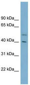Beta-1,4-Galactosyltransferase 2 antibody, TA336174, Origene, Western Blot image 