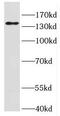 Intraflagellar transport protein 140 homolog antibody, FNab04154, FineTest, Western Blot image 