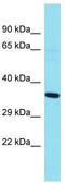 G Kinase Anchoring Protein 1 antibody, TA337319, Origene, Western Blot image 