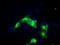 Scianna blood group antigen antibody, NBP2-02306, Novus Biologicals, Immunocytochemistry image 