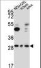 TATA-Box Binding Protein Associated Factor, RNA Polymerase I Subunit D antibody, LS-C161687, Lifespan Biosciences, Western Blot image 