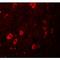 Zinc Finger And BTB Domain Containing 3 antibody, LS-B9511, Lifespan Biosciences, Immunofluorescence image 