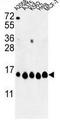 Histone Cluster 1 H2A Family Member H antibody, GTX81004, GeneTex, Western Blot image 