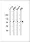 TPX2 Microtubule Nucleation Factor antibody, M01610-1, Boster Biological Technology, Western Blot image 
