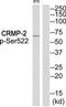 Dihydropyrimidinase Like 2 antibody, TA313766, Origene, Western Blot image 