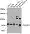 RAS Guanyl Releasing Protein 3 antibody, GTX33459, GeneTex, Western Blot image 