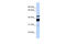 Ceramide Synthase 2 antibody, ARP32609_P050, Aviva Systems Biology, Western Blot image 