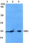 Growth Hormone 1 antibody, GTX66777, GeneTex, Western Blot image 