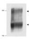 NPC Intracellular Cholesterol Transporter 1 antibody, GTX30687, GeneTex, Western Blot image 