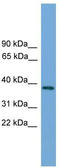 Leucine Rich Repeat Containing 75B antibody, TA335113, Origene, Western Blot image 
