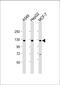 Klotho Beta antibody, 61-275, ProSci, Western Blot image 