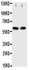 E2F-1 antibody, PA1560, Boster Biological Technology, Western Blot image 