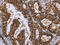 Leukotriene A4 Hydrolase antibody, CSB-PA918865, Cusabio, Immunohistochemistry paraffin image 