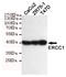 ERCC Excision Repair 1, Endonuclease Non-Catalytic Subunit antibody, STJ99240, St John