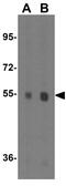 Plexin domain-containing protein 2 antibody, GTX85420, GeneTex, Western Blot image 