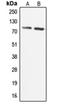Calcium/Calmodulin Dependent Serine Protein Kinase antibody, orb340839, Biorbyt, Western Blot image 