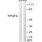 Rap guanine nucleotide exchange factor 5 antibody, A12923, Boster Biological Technology, Western Blot image 