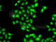Protein Inhibitor Of Activated STAT 3 antibody, A7060, ABclonal Technology, Immunofluorescence image 