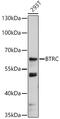 Beta-Transducin Repeat Containing E3 Ubiquitin Protein Ligase antibody, 18-324, ProSci, Western Blot image 
