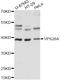 VPS26, Retromer Complex Component A antibody, A03951, Boster Biological Technology, Western Blot image 