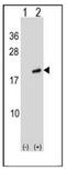 ADP Ribosylation Factor Like GTPase 2 antibody, AP50244PU-N, Origene, Western Blot image 