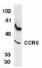 C-C Motif Chemokine Receptor 5 (Gene/Pseudogene) antibody, AP05821PU-N, Origene, Western Blot image 