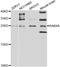 RAB4A antibody, LS-B14391, Lifespan Biosciences, Western Blot image 