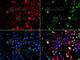 Valosin Containing Protein antibody, A2795, ABclonal Technology, Immunofluorescence image 