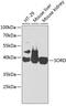 Sorbitol Dehydrogenase antibody, 18-514, ProSci, Western Blot image 