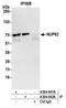 Nuclear pore glycoprotein p62 antibody, A304-941A, Bethyl Labs, Immunoprecipitation image 