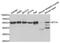 ETS Variant 4 antibody, PA5-76825, Invitrogen Antibodies, Western Blot image 