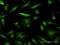 High mobility group protein HMG-I/HMG-Y antibody, H00003159-M03, Novus Biologicals, Immunocytochemistry image 