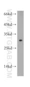 Suppressor Of Cytokine Signaling 3 antibody, 14025-1-AP, Proteintech Group, Western Blot image 
