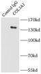 Collagen Type III Alpha 1 Chain antibody, FNab01838, FineTest, Immunoprecipitation image 