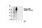 Platelet Derived Growth Factor Receptor Beta antibody, 3166S, Cell Signaling Technology, Western Blot image 