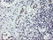 Zinc Finger BED-Type Containing 1 antibody, M11133-1, Boster Biological Technology, Immunohistochemistry paraffin image 
