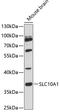 Sodium/bile acid cotransporter antibody, 14-599, ProSci, Western Blot image 