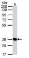 G Protein-Coupled Receptor 62 antibody, TA308711, Origene, Western Blot image 