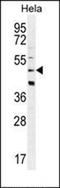 Protein Kinase AMP-Activated Non-Catalytic Subunit Beta 1 antibody, orb221337, Biorbyt, Western Blot image 