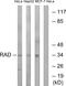 RRAD antibody, GTX87282, GeneTex, Western Blot image 