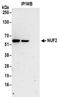 NUF2 Component Of NDC80 Kinetochore Complex antibody, NBP2-32210, Novus Biologicals, Immunoprecipitation image 